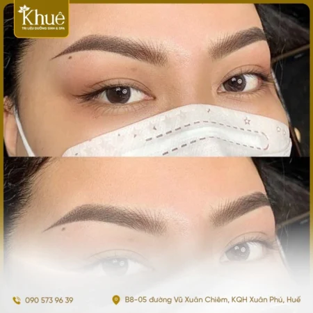 Phun xăm thẩm mỹ: Phun mày tại KHUÊ